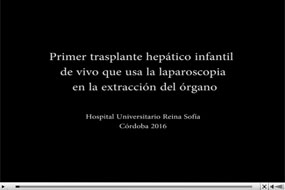 Video trasplante hepático infantil